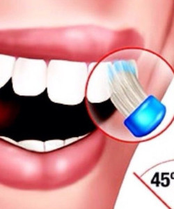 Preventing periodontal disease brushing