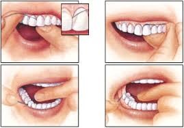 Preventing periodontal disease flossing